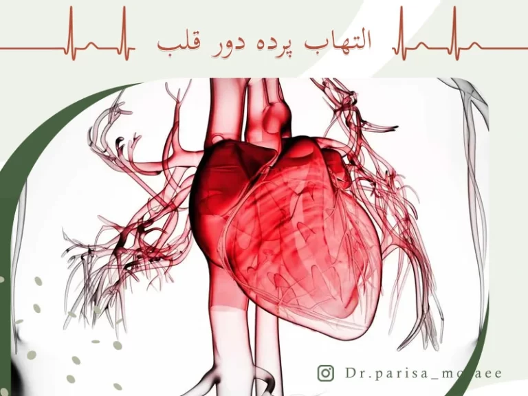 درباره التهاب پرده دور قلب