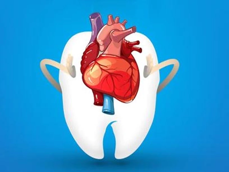 عفونت دندان چگونه باعث مشکلات قلبی می‌شود؟