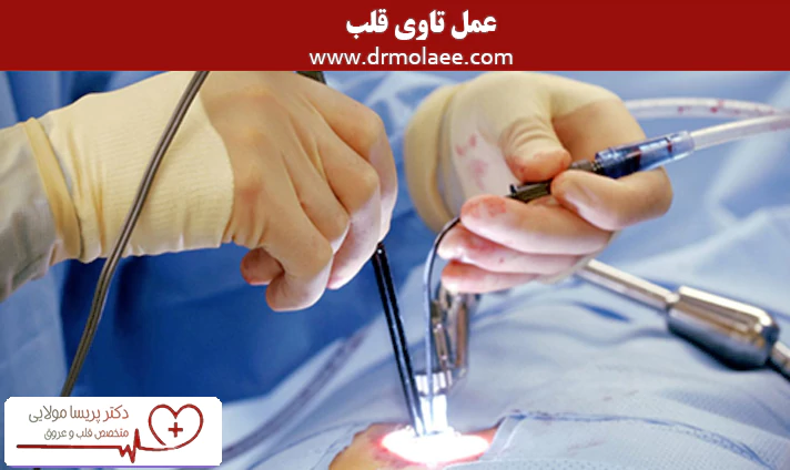 عمل تاوی قلب