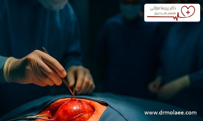 دلایل انجام جراحی بای پس عروق کرونر